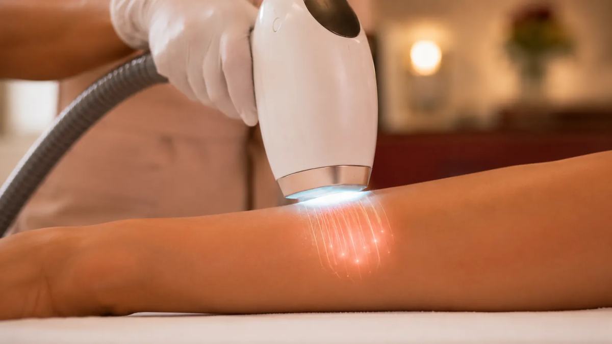 Diyot Lazer Nedir ve Nasıl Çalışır?